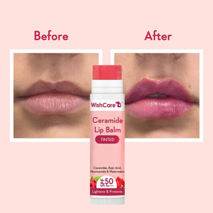WishCare Tinted Lip Balm with SPF 50 PA+++ Kojic Acid & Niacinamide Women -5g