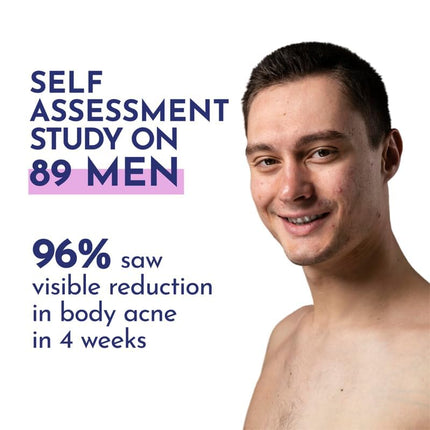 Mannlich 2% Salicylic Acid Body Acne Wash for Men (300 ml)