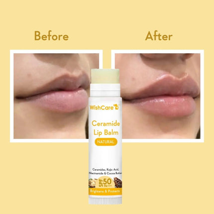 WishCare Ceramide Lip Balm with SPF 50 PA+++ 5g