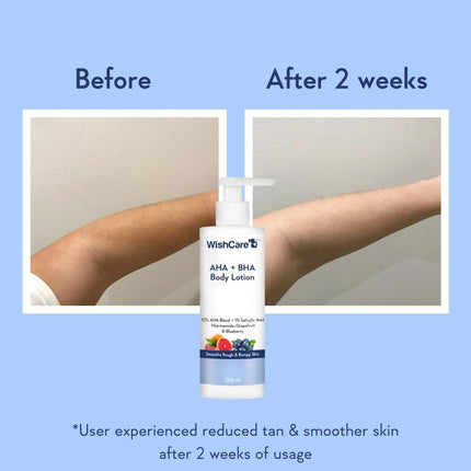 WishCare 10% AHA + 1% BHA Body Lotion- 200ml