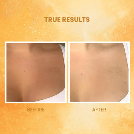 Suroskie Bloom Glaze 2-in-1 Body Scrub Wash-250ml