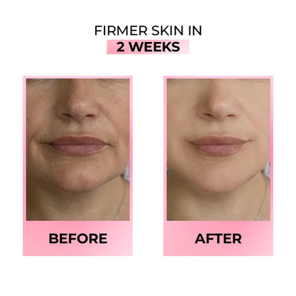 Streax Youthful Shine Face Serum, 30ml |11% Retinol & Peptide Complex