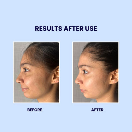 Suroskie Gluta Boost Face Wash Glutathione Beads & Niacinamide -100ml