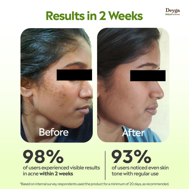 Deyga Aloe Vera Gel For Men & Women (100g)