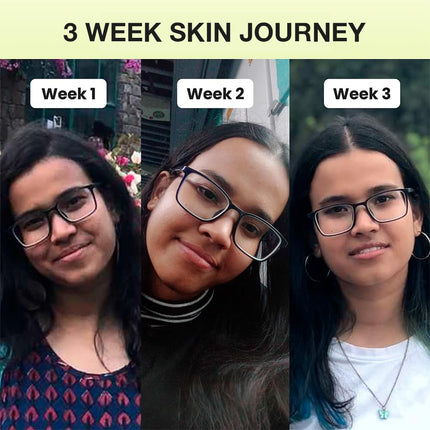 Cos-IQ 20% Niacinamide Face Serum with Vit B3 & Hyaluronic Acid | 30ml