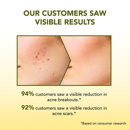 BELLAVITA Anti-Acne Face Wash -100 ml