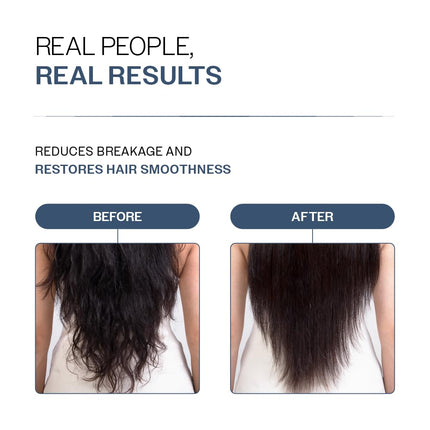 Bare Anatomy Anti-Hair Fall Conditioner with Redensyl, Rosemary & Peptides For All Hair Types | 175gm