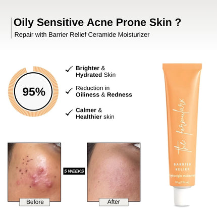 The Formularx Barrier Relief Ceramide Moisturizer  With Niacinamide & Hyaluronic Acid-50gm