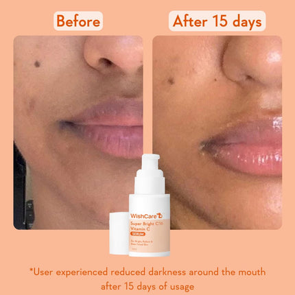 WishCare Super Serum Vitamin C,4% Niacinamide,1% Kojic Acid,0.5% Ferulic Acid,Licorice & 4-N-BR-30ml
