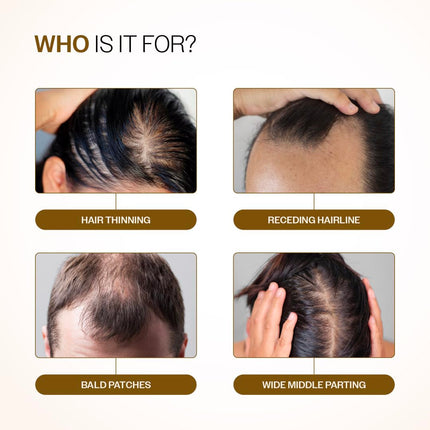 Bare Anatomy Advanced Hair Growth Serum Roll-On| 3% Redensyl + 4% Anagain + 2% Baicapil + 5% Rosemary, Rice Water, 25ml