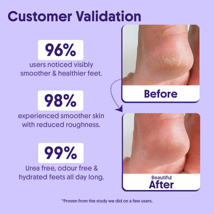 Aravi Organic 20% Urea Foot Roll-On With 0.5% Salicylic Acid, 5% Lactic Acid, 2% Glycolic Acid & 2% NMF Complex -50ml