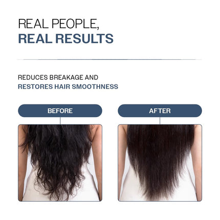 Bare Anatomy Anti-Hair Fall Shampoo & Conditioner Combo 250ml + 175gm