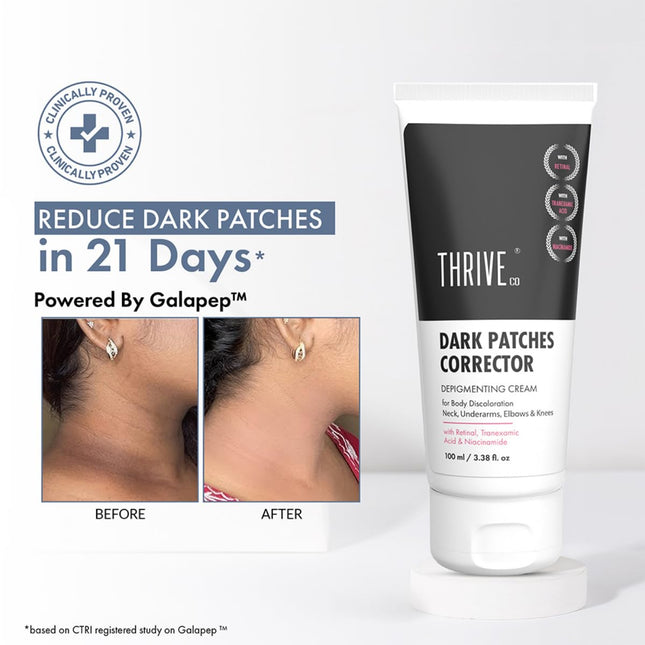ThriveCo Dark Patches Corrector Cream -100ml