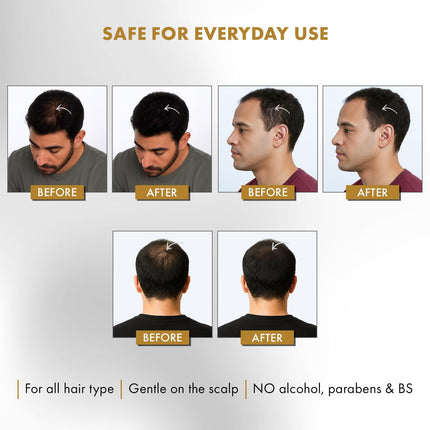 UrbanGabru Hair Building Fibers – Natural Black-12g