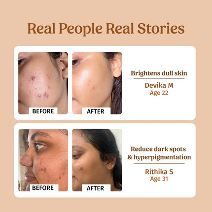 Vilvah Store Milk Drops Serum Formulated With Rice Milk Extract, Marine Algae Extract, Alpha Arbutin-40ml