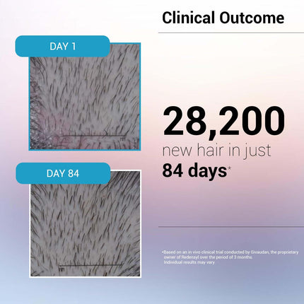 Sotrue Hair Growth Serum With 3% Redensyl For Women & Men, For All Hair Types, 30ml