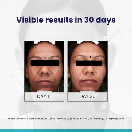 RE' EQUIL Oil Control Face Wash with Zinc PCA-200ml