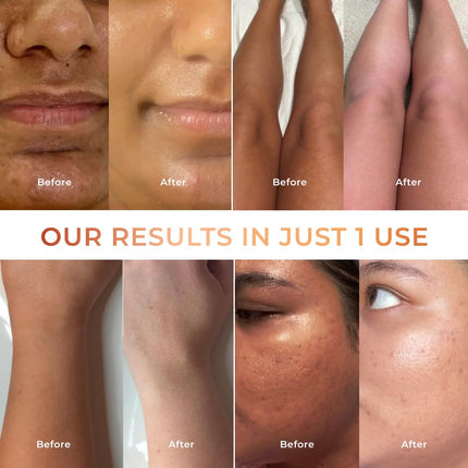NICONI Tan Vanish Gluta-Kojic Skin Polish with Kojic Acid & Glutathione-180g