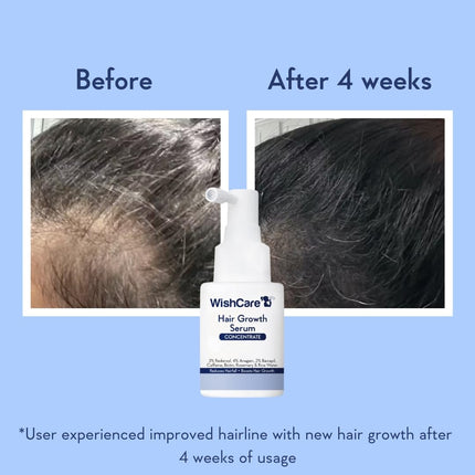 WishCare Hair Growth Serum Concentrate - Resdensyl, Anagain, Caffeine, Biotin, Keratin & Rice Water 20ml