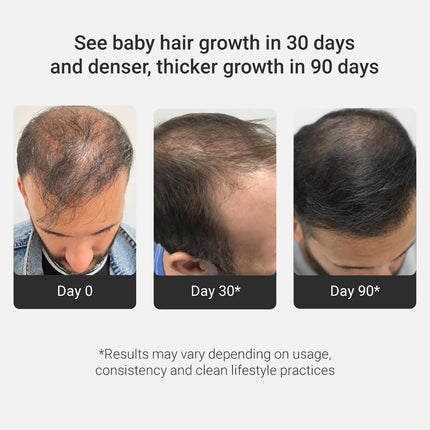 Arata Grow Strong Combo | Intensive Hair Growth Serum & Super Shampoo 300ml + 30ml