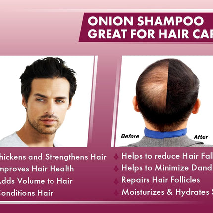 UrbanGabru Red Onion Shampoo-200gm