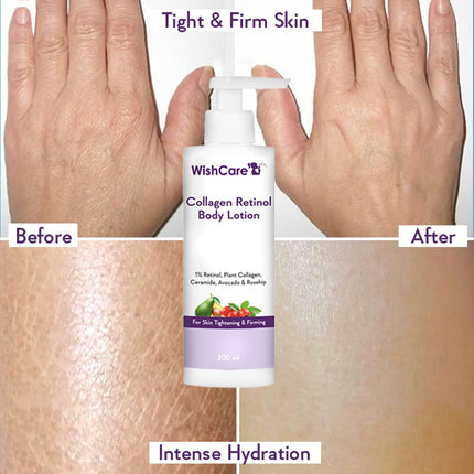 WishCare Collagen 1% Retinol Body Lotion-200 Ml