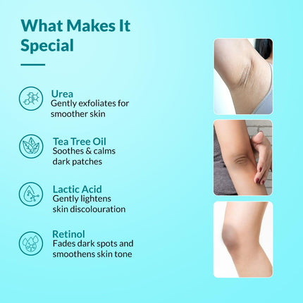 Fixderma Nigrifix Cream for Acanthosis Nigricans with Lactic Acid For Body Parts-100 gm