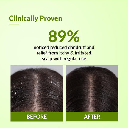 Fixderma Kairfoll Anti Dandruff Shampoo-15 ml