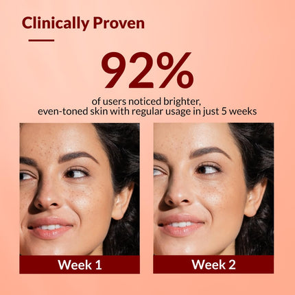 Fixderma Tranexamic Acid + 2% Kojic Acid + 1% Arbutin SKARFIX -TX Face Cream