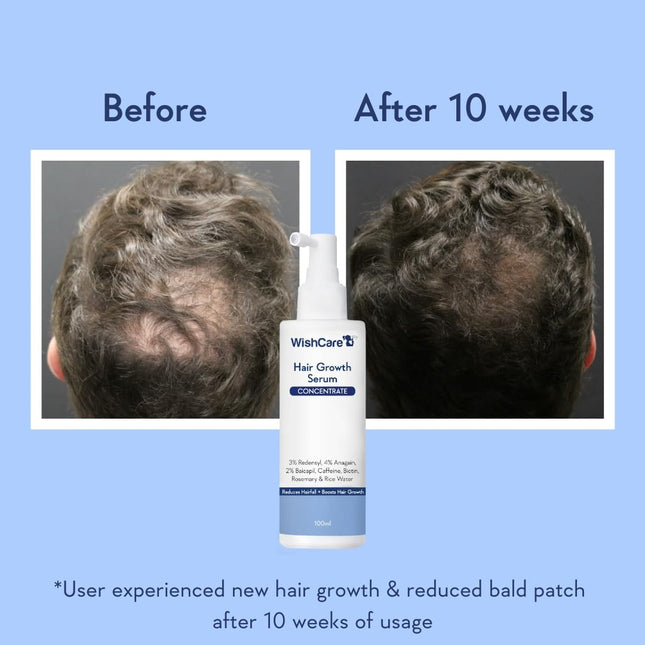 WishCare Hair Growth Serum Concentrate - 3% Redensyl, 4% Anagain, 2% Baicapil, Caffeine, Biotin & Rice Water -100ml