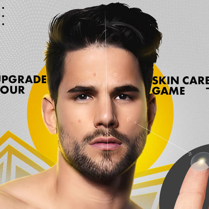 UrbanGabru Acne Pimple Patch - 72 Invisible Facial Stickers
