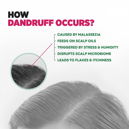 Sebamed Anti Dandruff Shampoo 200 ml | pH 5.5