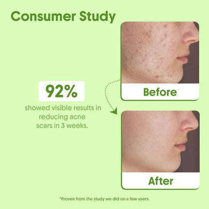 Aravi Organic Tea Tree Essential Oil For Skin, Hair, Face, Acne Care, Dandruff-15 ml