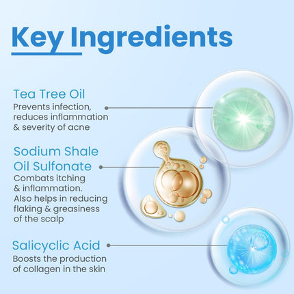 FIXDERMA COSMETIC LABORATORIES T-Shampoo For Dandruff, Scalp Psoriasis, Scalpe Shampoo-200 ml