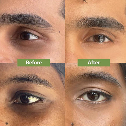 Vilvah Store Under Eye Cream | For Dark Circles-20ML