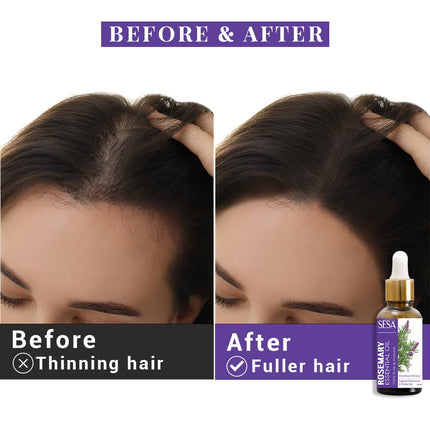 Sesa Rosemary Essential Oil for Hair Growth and Nourishes Skin-15ml