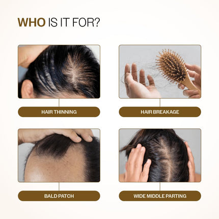 Bare Anatomy Advanced Hair Growth Serum | 3% Redensyl, 4% Anagain, 3% Baicapil, 1% Capilia Longa, Rosemary, Biotin & Rice Water-20ml