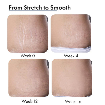 ThriveCo Stretch Marks Expert Serum Cream -30ml