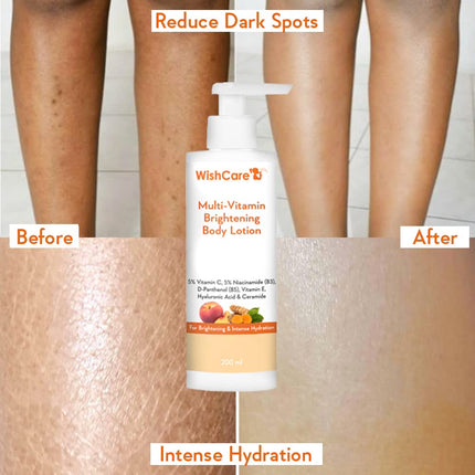 WishCare Multi-Vitamin Body Lotion - 5% Vitamin C, 5% Niacinamide-200 Ml