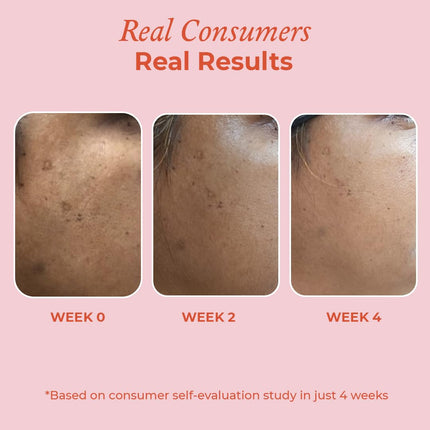 The Pink Foundry 15% Vitamin C Face Serum-30ml
