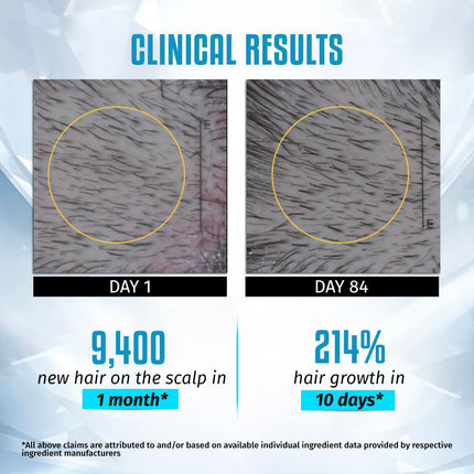 Sesa Ayuscience 3% Redensyl, 4% Anagain, 2% Kerascalp Hair Growth Serum-30ml