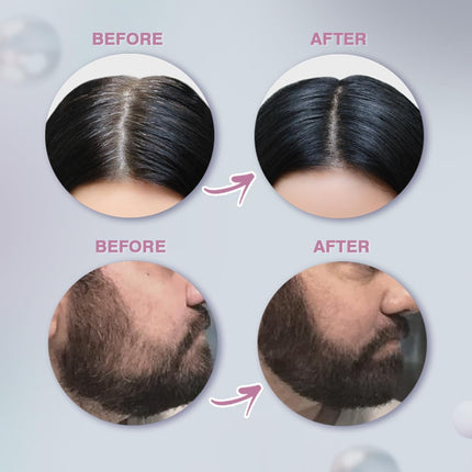 Glamveda Cover-Up Hair Powder - Black 4gm