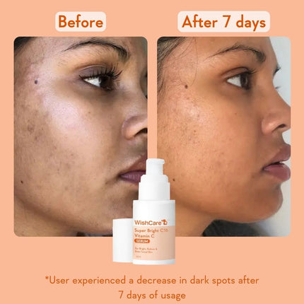 WishCare Super Serum Vitamin C,4% Niacinamide,1% Kojic Acid,0.5% Ferulic Acid,Licorice & 4-N-BR-30ml