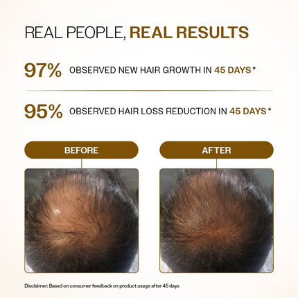 Bare Anatomy Advanced Hair Growth Serum Roll-On| 3% Redensyl + 4% Anagain + 2% Baicapil + 5% Rosemary, Rice Water, 25ml