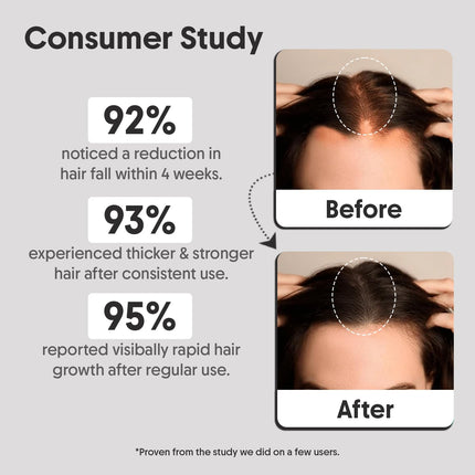 Aravi Organic Hair Growth Serum With 3% Redensyl, 2% Anagain, 2% Procapil - 30 ml