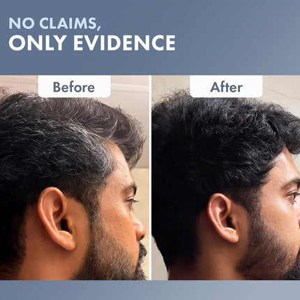 ThriveCo Permanent Hair Color Creme | 100% Grey Hair Coverage -70 ml