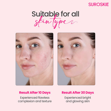 SUROSKIE Rose Instant Enzyme Face Scrub 50ml