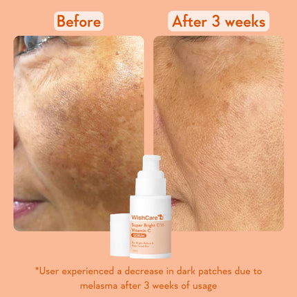 WishCare Super Serum Vitamin C,4% Niacinamide,1% Kojic Acid,0.5% Ferulic Acid,Licorice & 4-N-BR-30ml