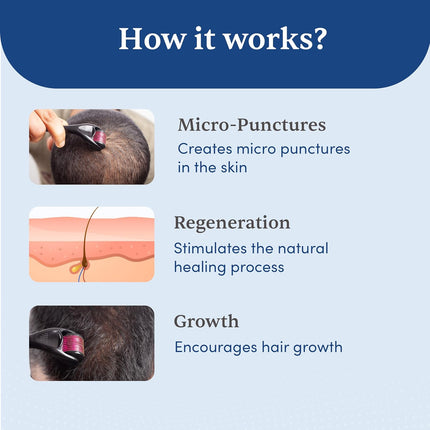 Man Matters Derma roller 1.00 mm With 540 Titanium Alloy Needles