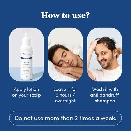Man Matters Anti Dandruff Lotion for Men [60ml]